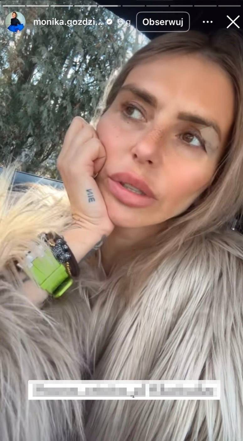 Monika Goździalska rozprawia o zabiegu