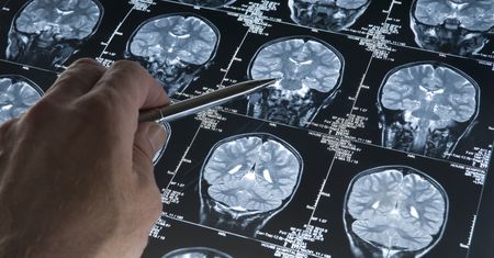 Pacjenci widzą zmarłych. Tajemnicza choroba. Lekarze nie wiedzą, co się dzieje