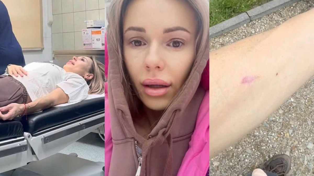 Doda pokazała bliznę po operacji