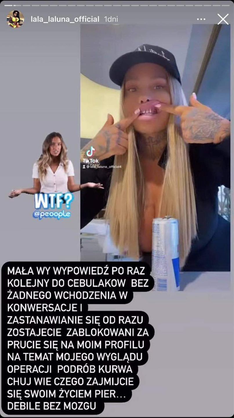 Laluna Unique zrobiła nowe zęby