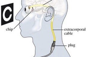Cyberpunkowe implanty do oczu 1
