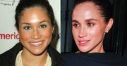 Ekspertka ruga Meghan Markle za zmiany w wyglądzie. W tle ZABIEGI, którym miała się poddać