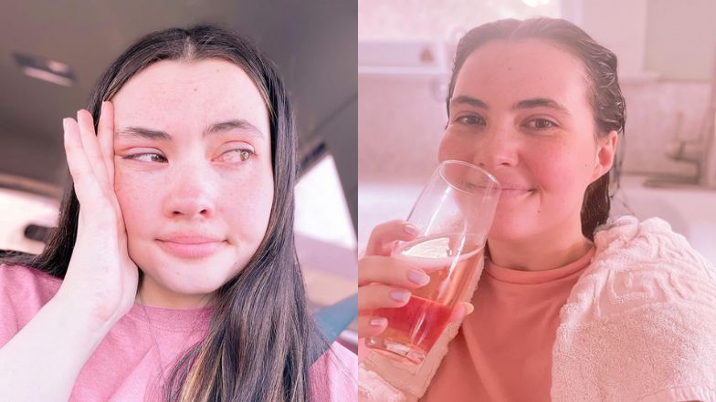 25-latka żyje z alergią na wodę