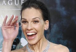 Cellulit i żylaki na wierzchu. Czyje to nogi?