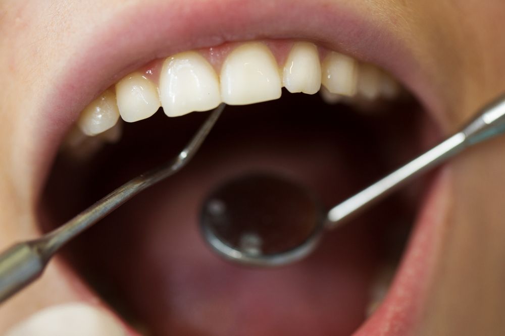 Lek na infekcje jamy ustnej wycofany z obrotu
