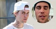 Justin Bieber walczył z poważną chorobą. Jego twarz była częściowo sparaliżowana