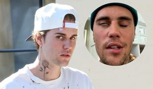 Justin Bieber walczył z poważną chorobą. Jego twarz była częściowo sparaliżowana