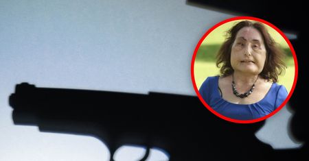 Mąż zniszczył jej twarz. Przeszła kilkadziesiąt operacji