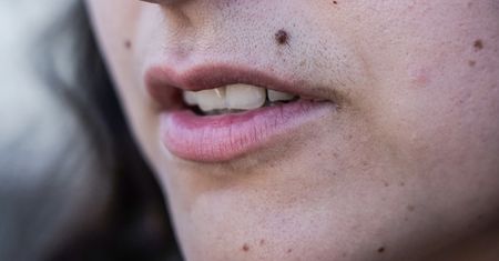Wymieszaj z wodą i wsmaruj. Włoski nad górną wargą zaczną wypadać