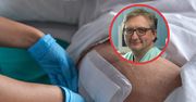 W Polsce nie ma publicznych centrów leczenia ran. Dr Przemysław Lipiński: Może skończyć się amputacją