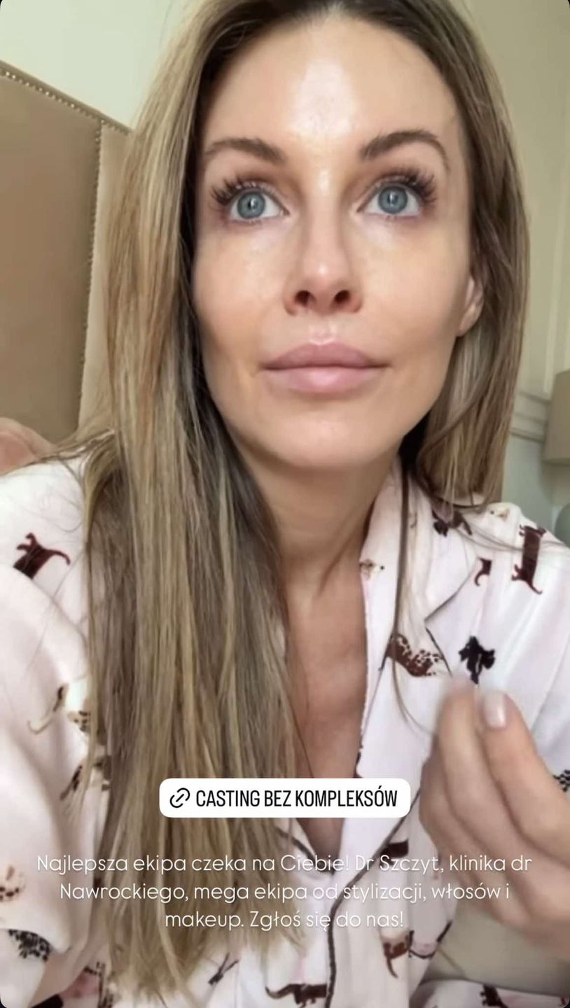 Małgorzata Rozenek prezentuje "naturalne" oblicze z rana