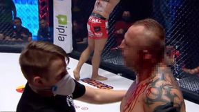 Fatalna kontuzja podczas gali MMA. Widok mrozi krew w żyłach. Uwaga, wideo drastyczne
