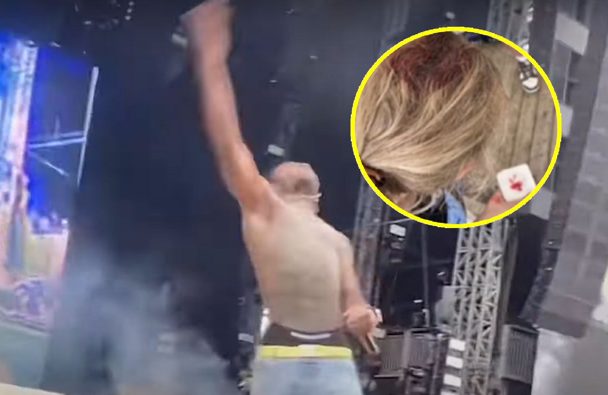 Lil Uzi Vert trafił telefonem w głowę fanki