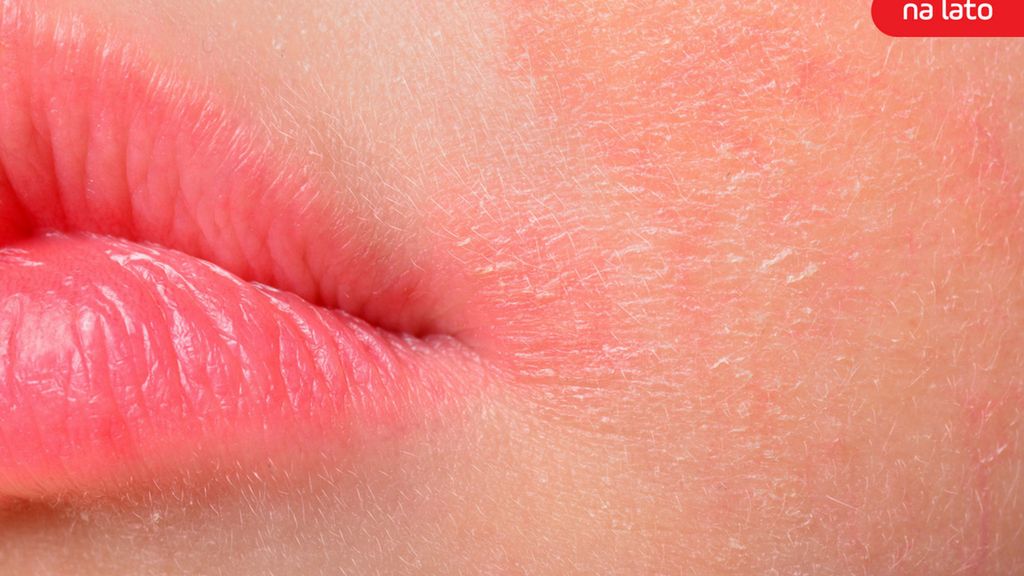 Leiszmaniozą możesz zarazić się w Hiszpanii [123rf.com]