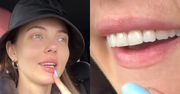 Marcela Leszczak ROZPACZA nad swoimi drogocennymi zębami: "Zostawiłam ponad 20 tys. złotych, lekarz obiecywał góry..."