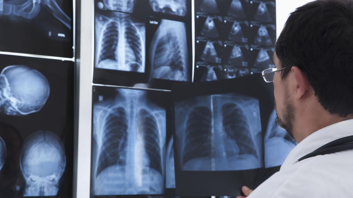 Pletyzmografia to badanie płuc i naczyń krwionośnych