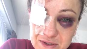 UFC. Karolina Kowalkiewicz wraca do Polski. Lekarz wydał zgodę na podróż samolotem