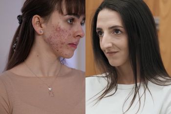 Nie mogły na siebie patrzeć. Po metamorfozach są nie do poznania