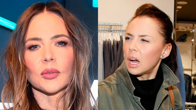 Maja Sablewska żałuje korzystania z medycyny estetycznej