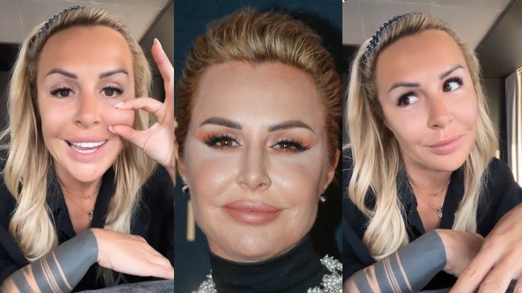 Blanka Lipińska cierpliwie wylicza, "CO MA W TWARZY ZROBIONEGO"