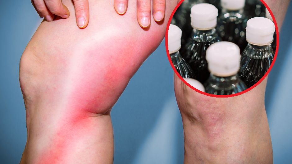 Słodycze pośrednio zwiększają ryzyko zakrzepicy