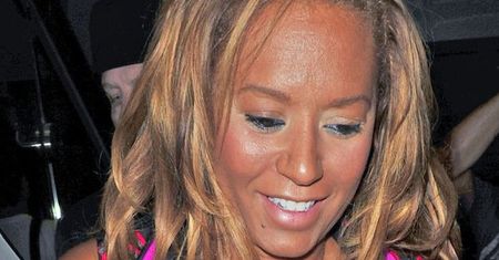 Mel B: Jej twarz wygląda strasznie! A kiedyś była taka piękna...