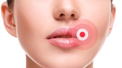 Wirus opryszczki zwiększa ryzyko choroby Alzheimera?