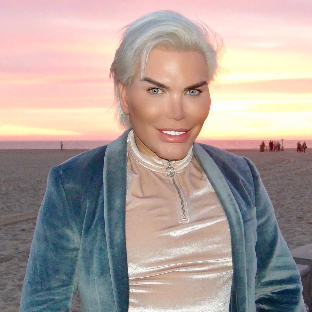 Rodrigo Alves - żywy Ken wyciął sobie cztery żebra