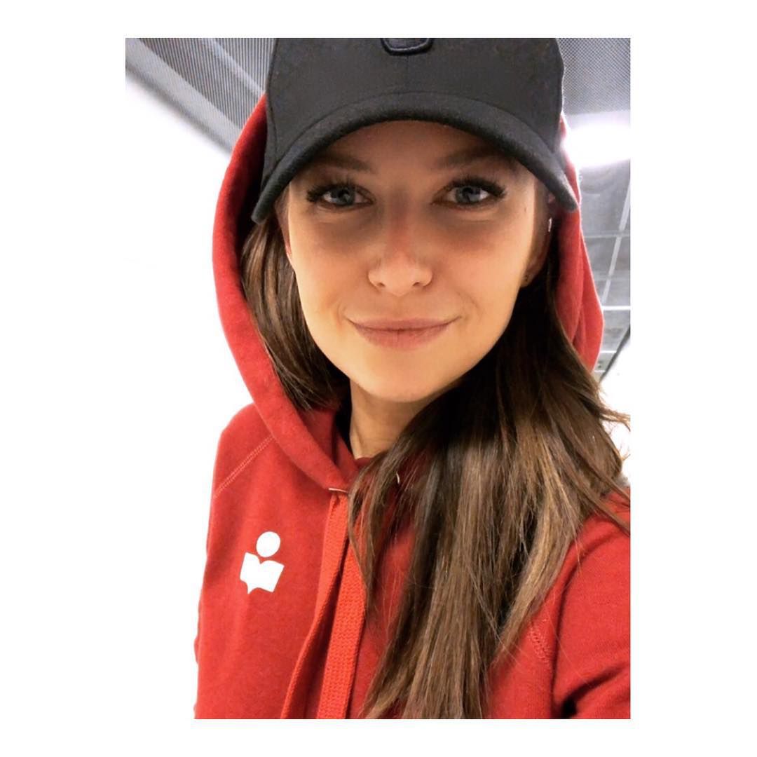 Anna Lewandowska powiększyła usta?