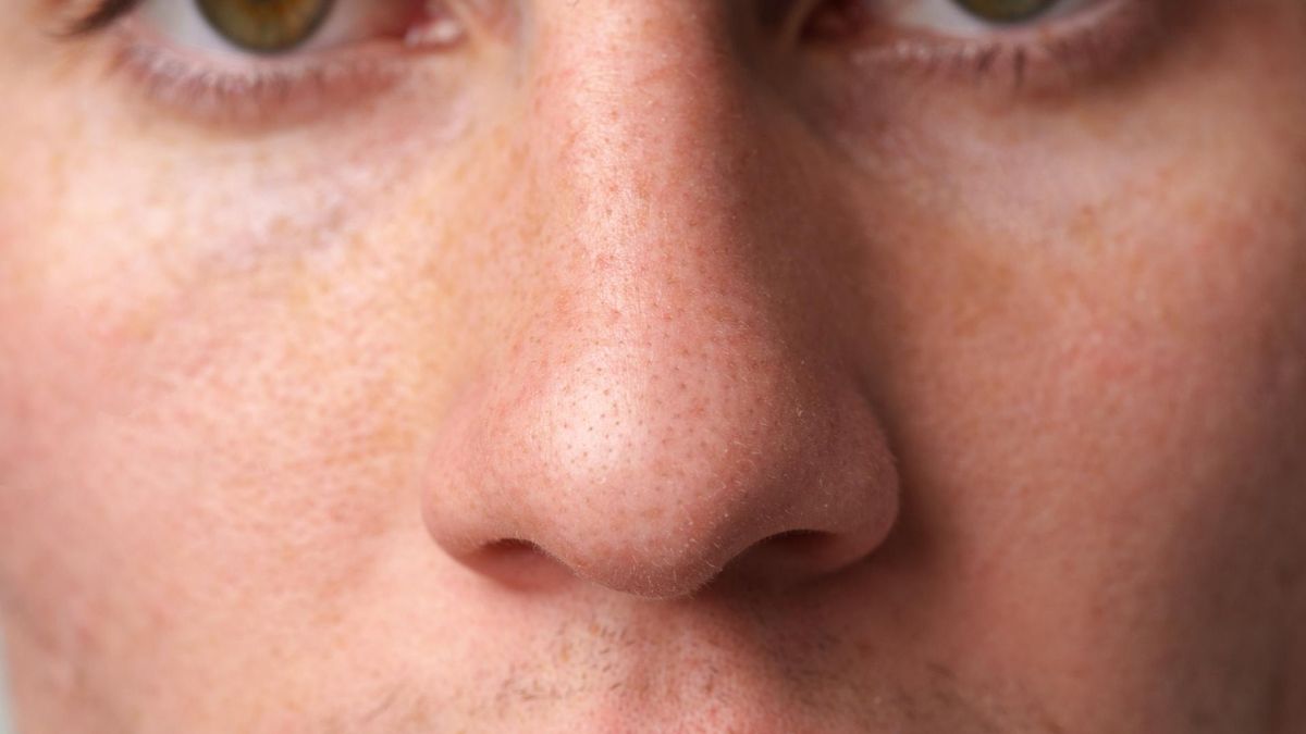 Jak wykryć raka nosa?