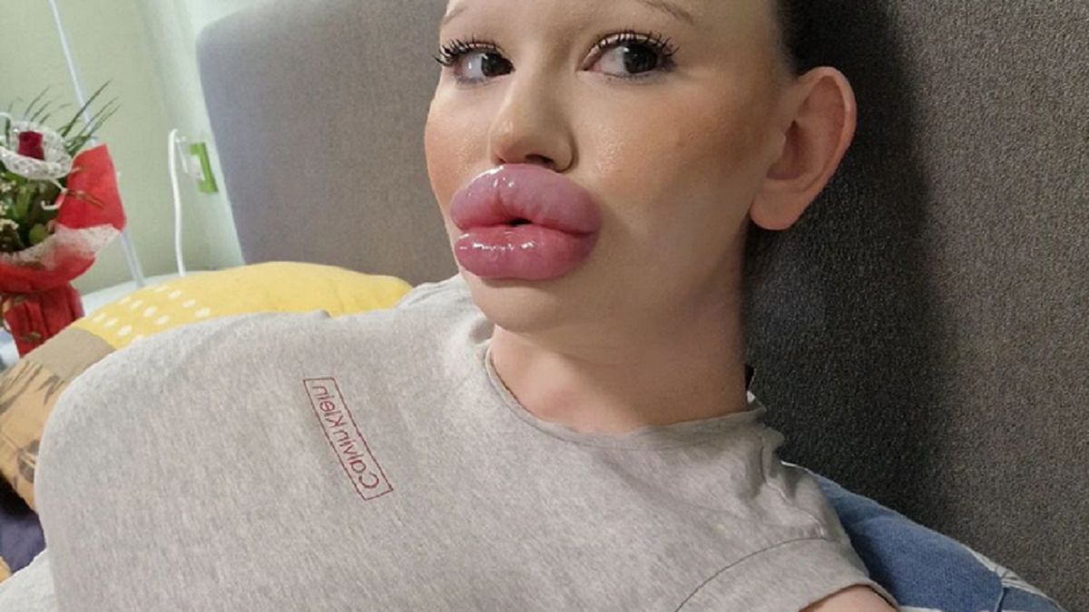 Andrea obsesyjnie powiększa usta.