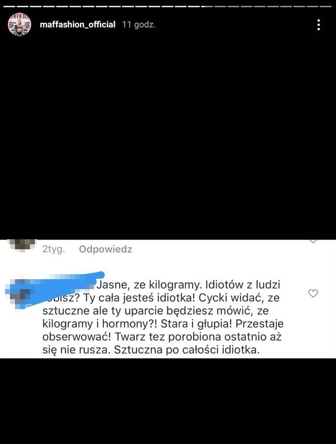 Maffashion odpiera zarzuty o powiększenie biustu i apeluje o empatię
