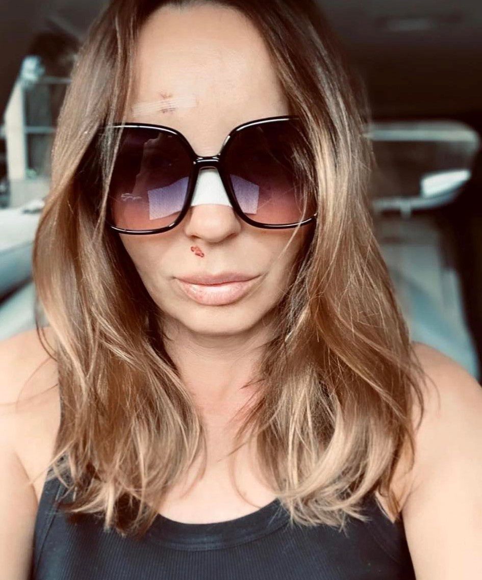 Agnieszka Włodarczyk TRAFIŁA DO SZPITALA
