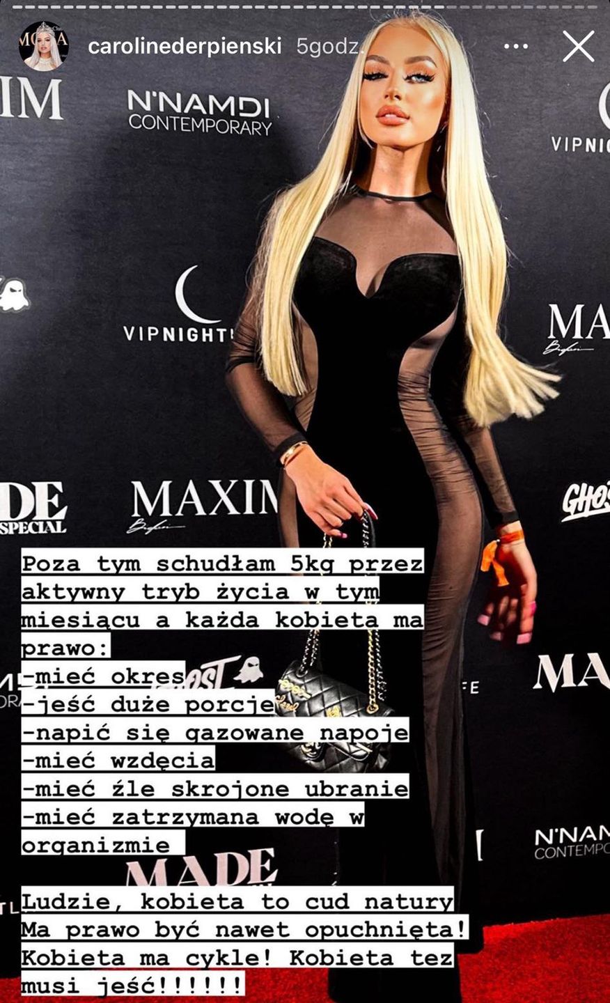 Caroline Derpienski skrytykowana za wygląd