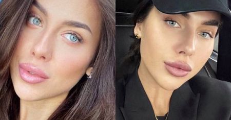 26-letnia Rosjanka zoperowała nos. Fatalny finał