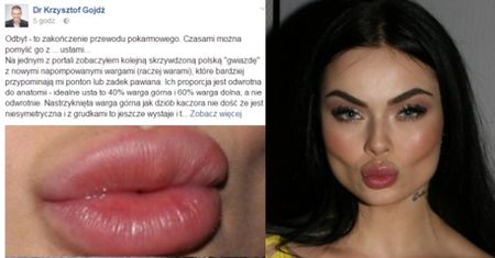 Gojdź o ustach Luxurii: "ODBYT, PAWIANICA W ZOO! Kolejna skrzywdzona polska "gwiazda" z napompowanymi warami"