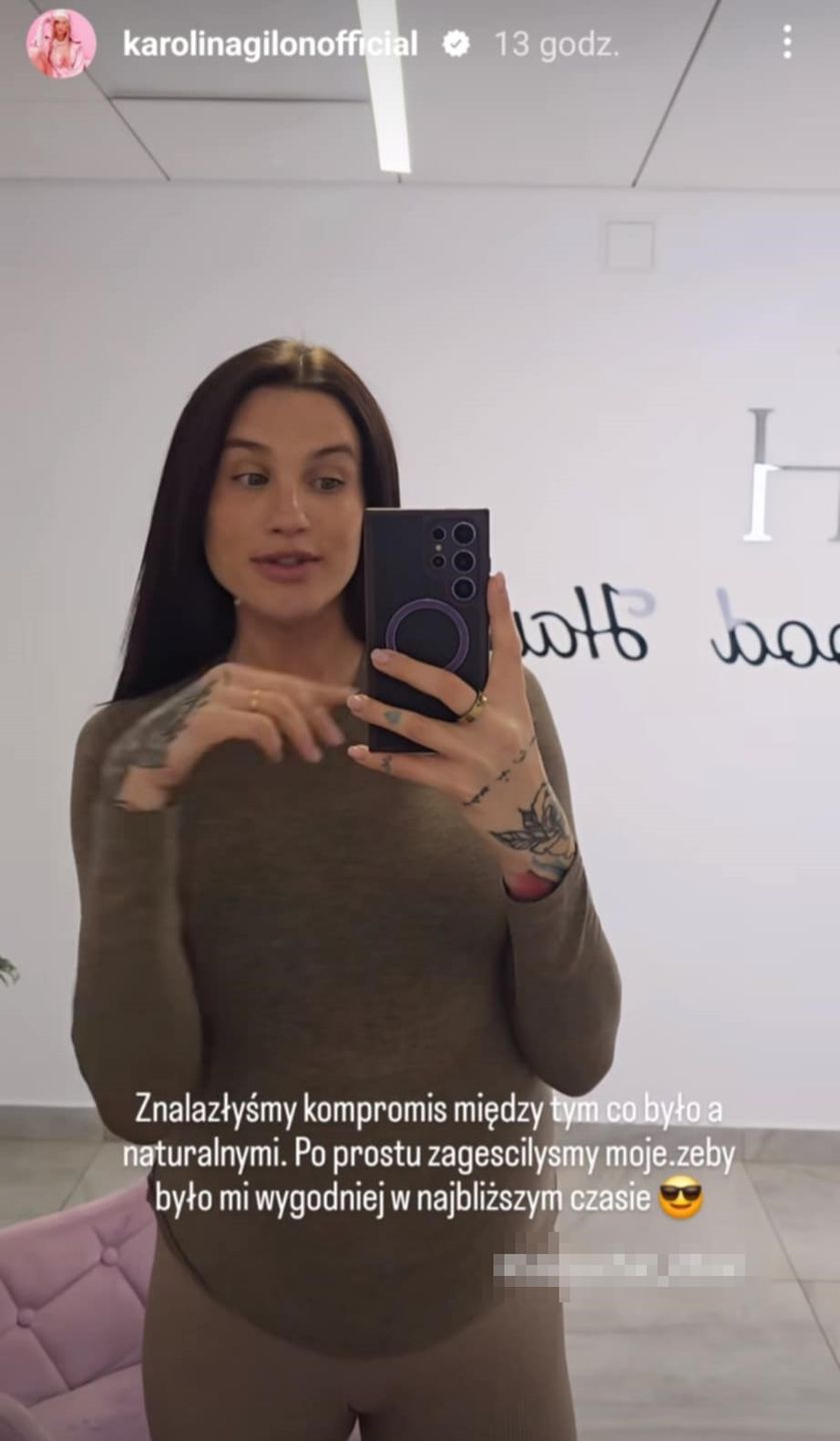 Karolina Gilon bez doczepów