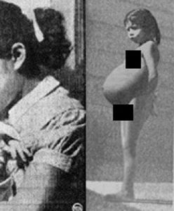 5-latka w ciąży. Została najmłodszą matką w historii