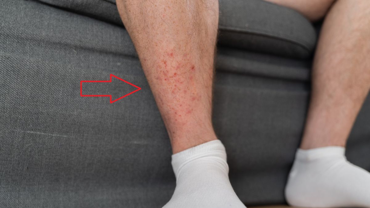 Jakie objawy daje chora trzustka?