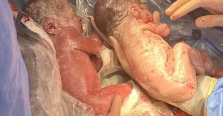 Urodziły się w Warszawie. Rodzice bliźniaków oniemieli