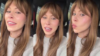 Dramat Julii von Stein: na jej twarzy po liftingu pojawiła się ZMARSZCZKA. Współczujecie?