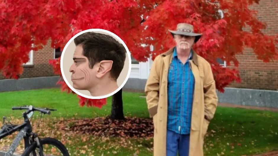 Jest jedną z 75 osób na świecie, które cierpią na "syndrom twarzy demona"