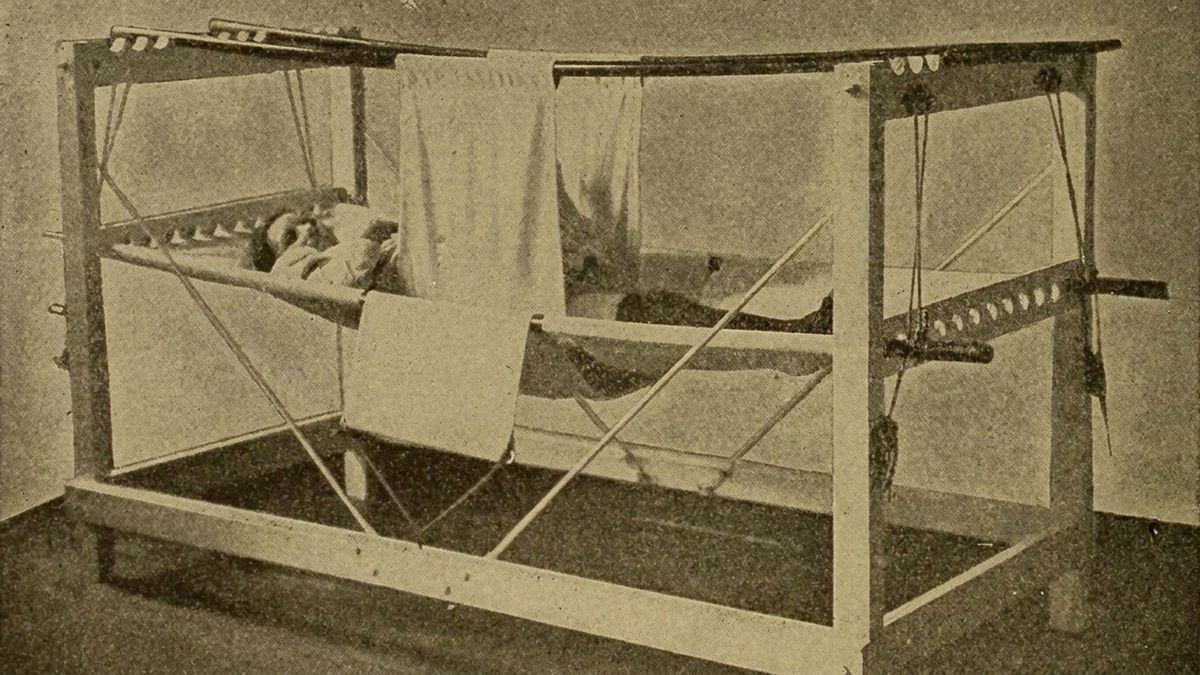 Łoże Ayresa do stabilizacji miednicy po symfizjotomii, 1907 rok.