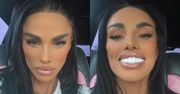 Katie Price prezentuje nowy nos i OŚLEPIA białymi licówkami
