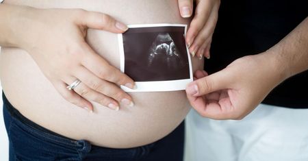 Aborcja jednego z bliźniaków możliwa bez względu na stan zdrowia dziecka