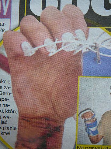 Obraz