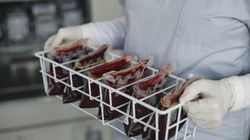 Zwiększa ryzyko raka? Badacze pochylili się nad grupami krwi