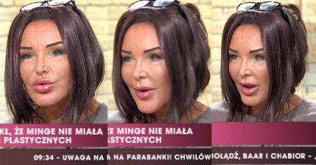 Minge: "Przepraszam, że jestem taka brzydka!" Jej TWARZ ZBADAŁ BIEGŁY!