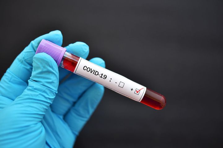 Innowacyjny test odporności na COVID-19. Zbada kilka rodzajów przeciwciał