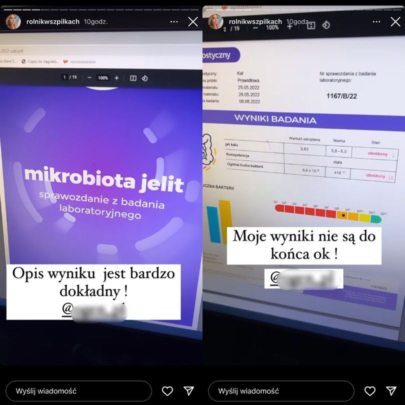 Małgorzata Borysewicz z "Rolnik szuka żony" prezentuje wyniki badania jelit